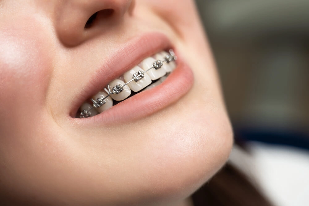 Orthodontics